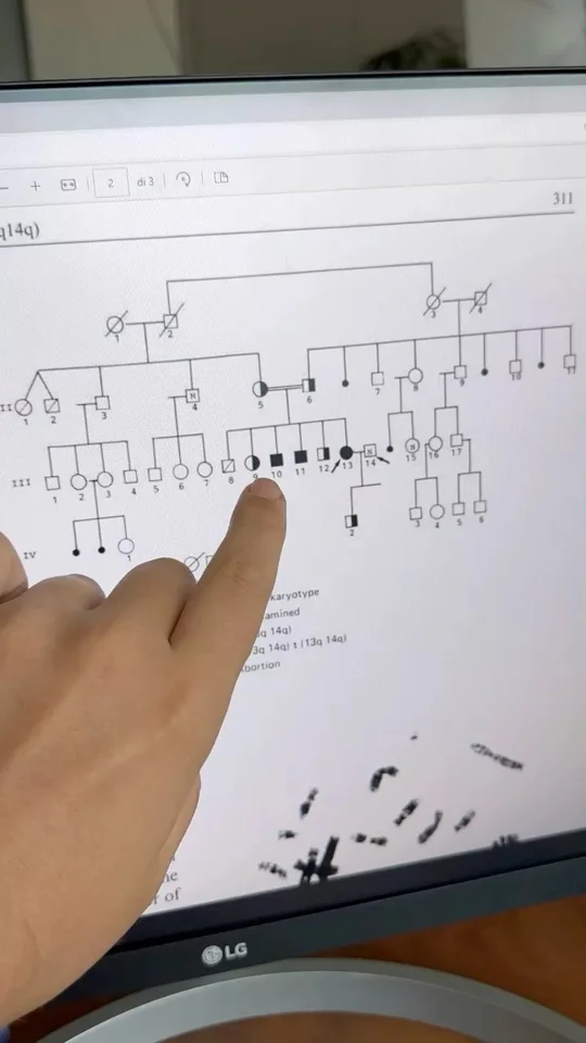 Published reel preview: Esistono persone con 44 cromosomi: potrebbero diventare una nuova specie umana?